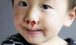 吃凉瓜流鼻血怎么办啊视频,紧急应对指南