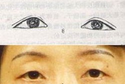 吃瓜娃娃面相图解视频大全,揭秘面相中的趣味与智慧